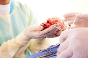 Més informació sobre l'article Es pot trasplantar qualsevol òrgan